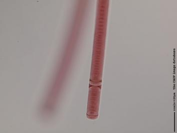 N018 100x.JPG